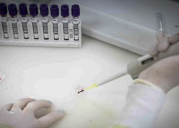 Paciente em São Paulo com suspeita de ebola testa positivo para meningite