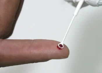 Fiji declara emergência nacional por HIV com 1 caso a cada 60 pessoas