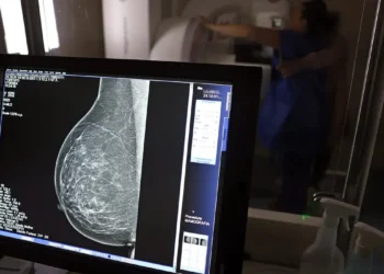 Entidades alertam médicos sobre pedidos de mamografia digital
